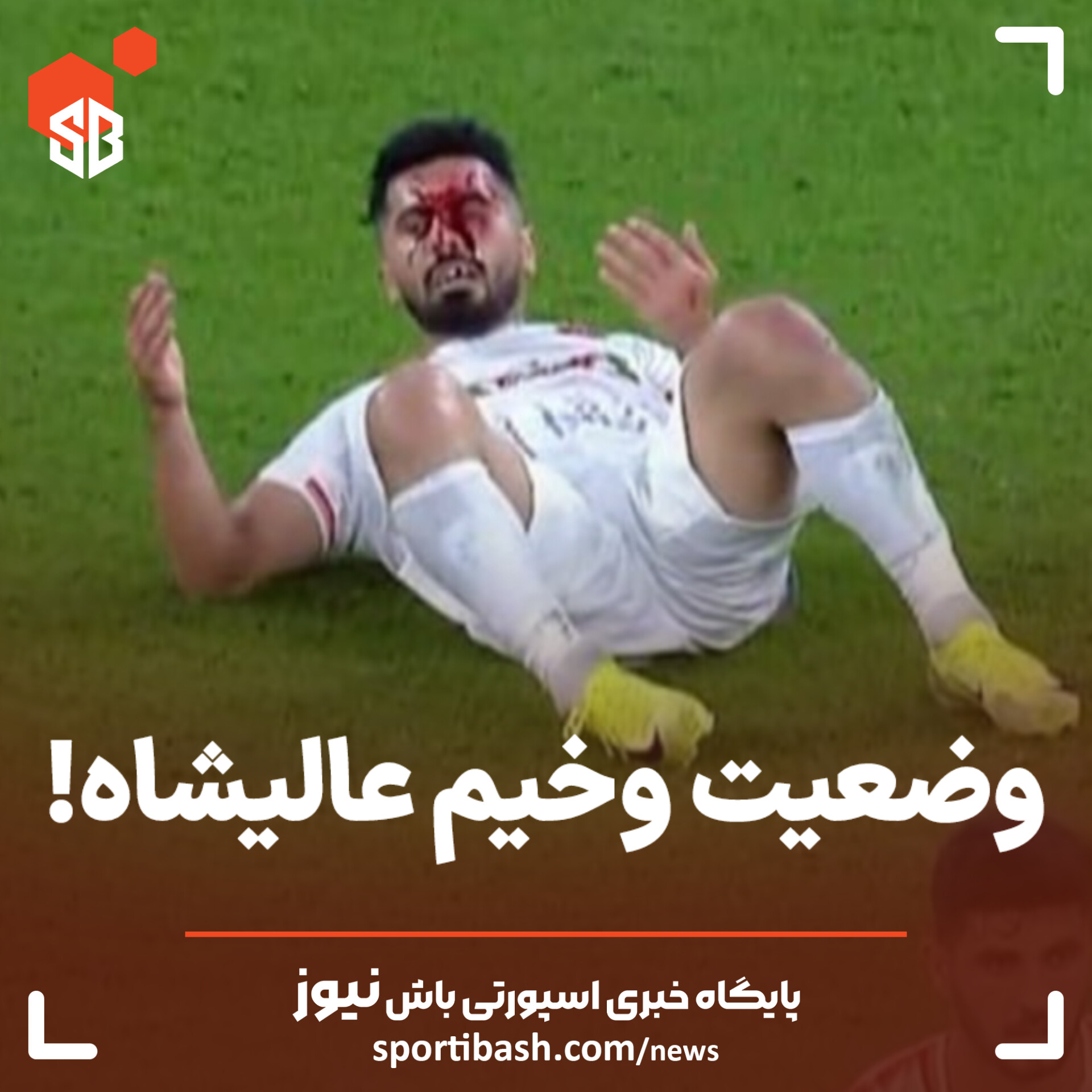 وضعیت وخیم عالیشاه!